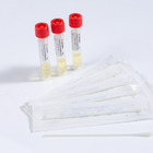 Extraction Free Single Use Virus Sampling Tube Disposable